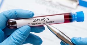 У Києві швидко зростає кількість пацієнтів із COVID, які потребують госпіталізації